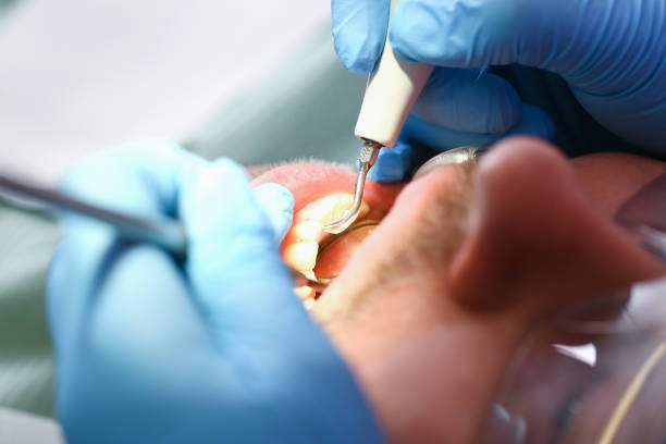 Best Root Canal Emergency Dentist  in Orida City, FL